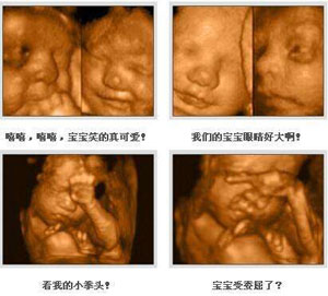 <a data-cke-saved-href=http://www.gyhemei.com/ href=http://www.gyhemei.com/ target=_blank class=infotextkey>西安雁塔大爱妇产医院</a>