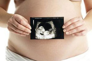 西安做四维彩超大概多少钱?