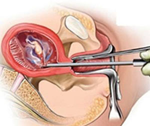 西安女子医院做妇科检查_大爱妇产医院怎么样_大爱妇产女子医院_西安女子医院_大爱妇产医院月经不调_大爱妇产医院无痛人流_小寨妇产医院