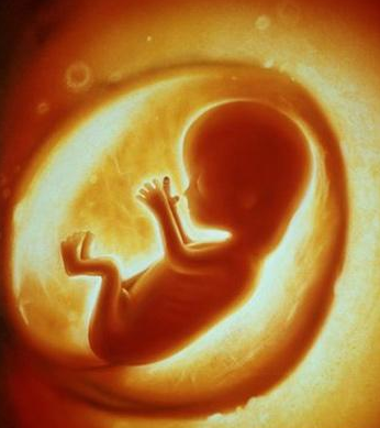 羊水多是怎么回事?